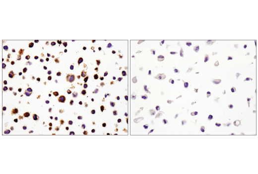 Immunohistochemistry Image 7: PD-L1 (E1L3N®) XP® Rabbit mAb (BSA and Azide Free)