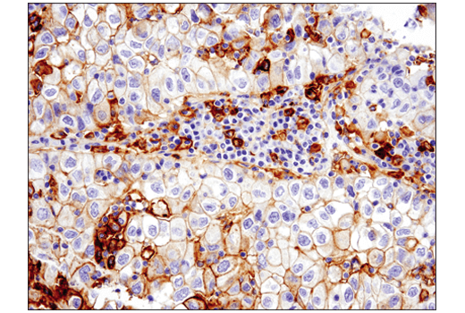 Immunohistochemistry Image 1: PD-L1 (E1L3N®) XP® Rabbit mAb (BSA and Azide Free)