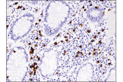 Immunohistochemistry Image 1: CD8α (D8A8Y) Rabbit mAb