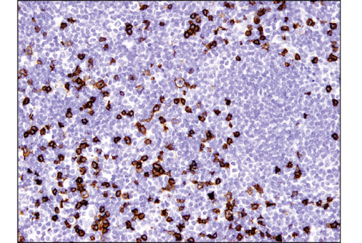 Immunohistochemistry Image 3: CD8α (D8A8Y) Rabbit mAb