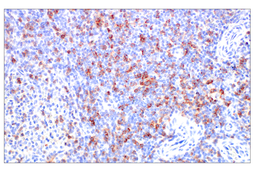 Immunohistochemistry Image 4: CD8α (D8A8Y) Rabbit mAb