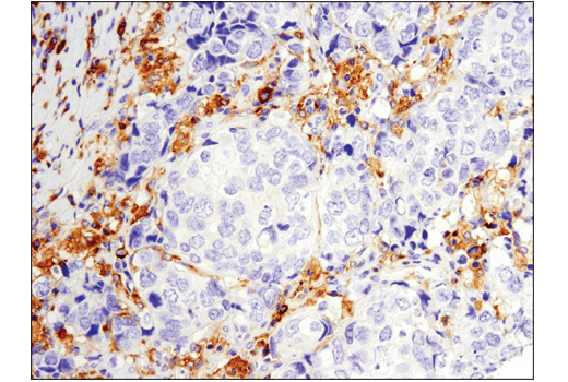  Image 16: B Cell Signaling Antibody Sampler Kit II