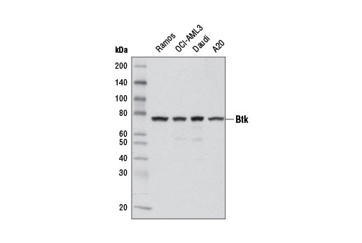  Image 2: PhosphoPlus® Btk (Tyr223) Antibody Duet