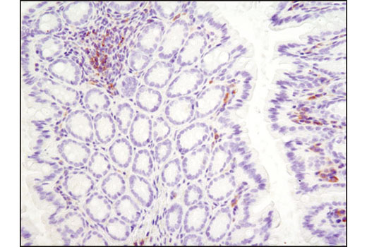  Image 7: PhosphoPlus® Btk (Tyr223) Antibody Duet
