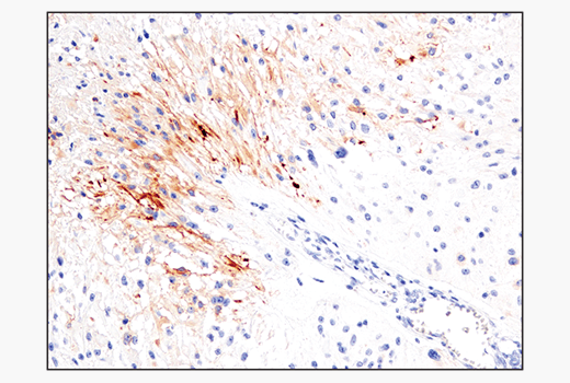 Immunohistochemistry Image 3: IL-13RA2/CD213a2 (E7U7B) Rabbit mAb