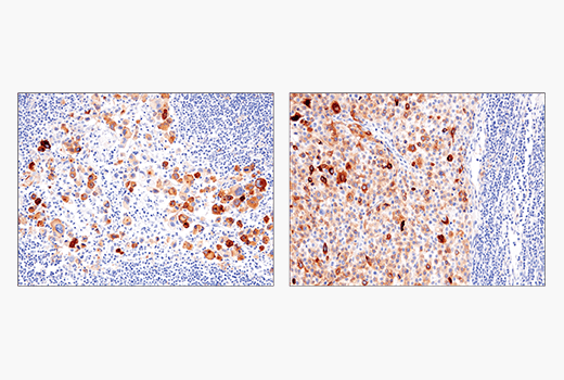 Immunohistochemistry Image 5: IL-13RA2/CD213a2 (E7U7B) Rabbit mAb
