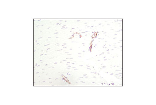 Immunohistochemistry Image 7: CD31 (PECAM-1) (89C2) Mouse mAb (BSA and Azide Free)