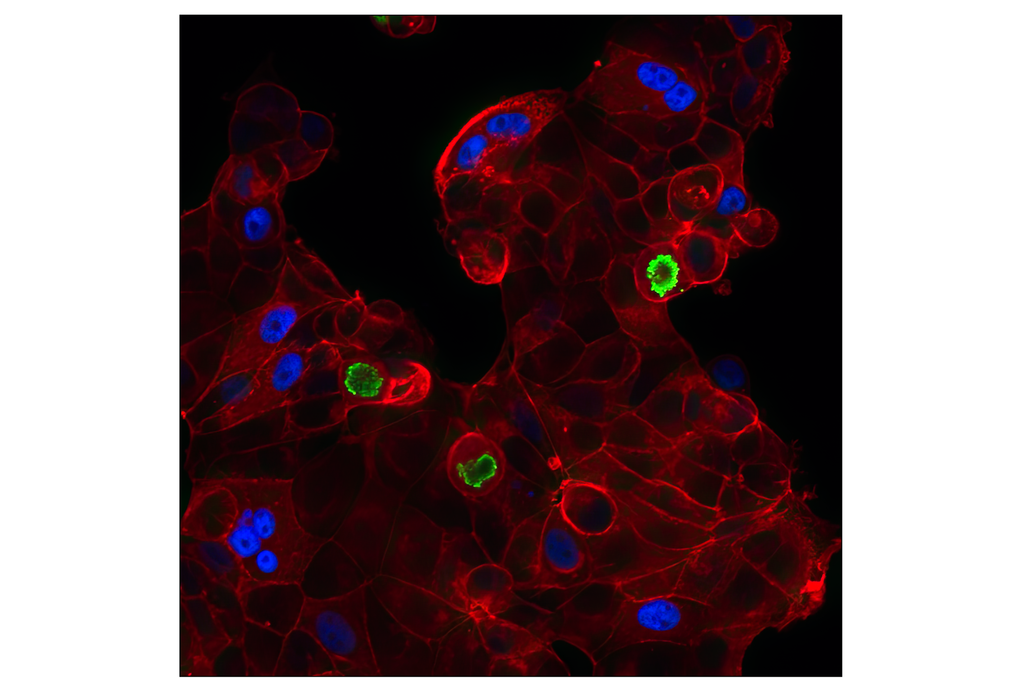 Immunofluorescence Image 1: p21 Waf1/Cip1 (12D1) Rabbit mAb (Alexa Fluor® 647 Conjugate)