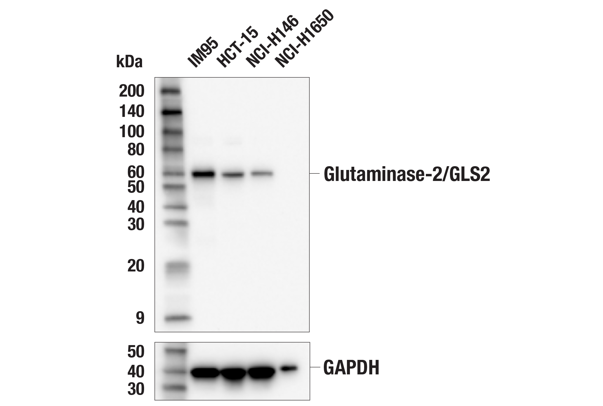  Image 9: Glutamine Metabolism Antibody Sampler Kit