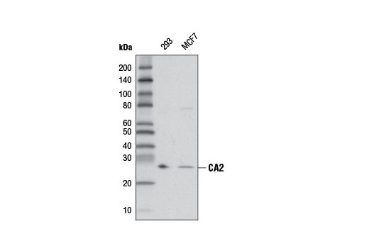 Western Blotting Image 1: CA2 Antibody