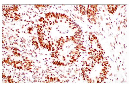 Immunohistochemistry Image 1: METTL3 (E3F2A) Rabbit mAb