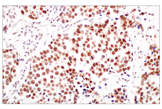 Immunohistochemistry Image 3: METTL3 (E3F2A) Rabbit mAb