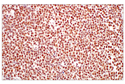 Immunohistochemistry Image 4: METTL3 (E3F2A) Rabbit mAb