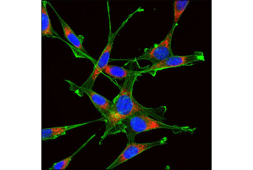 Immunofluorescence Image 1: PDI (C81H6) Rabbit mAb (Alexa Fluor® 594 Conjugate)