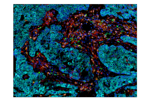  Image 53: Human Exhausted T Cell Antibody Sampler Kit