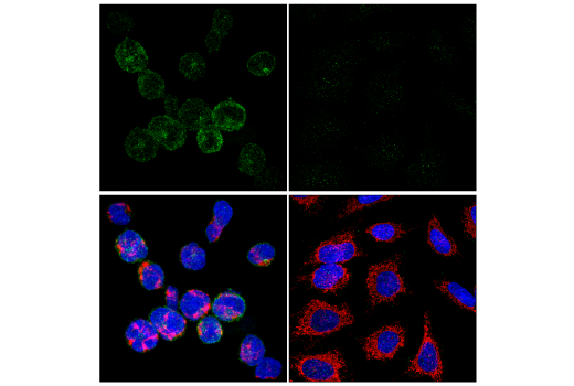  Image 2: Human Exhausted CD8+ T Cell IHC Antibody Sampler Kit