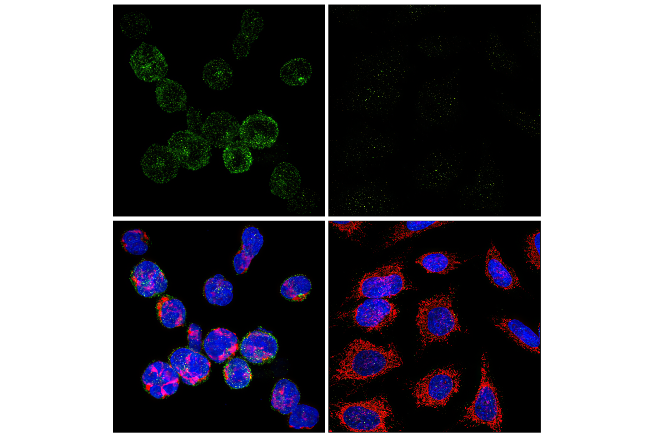Immunofluorescence Image 1: PD-1 (Intracellular Domain) (D4W2J) XP® Rabbit mAb