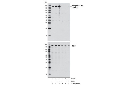  Image 9: AS160 Signaling Antibody Sampler Kit