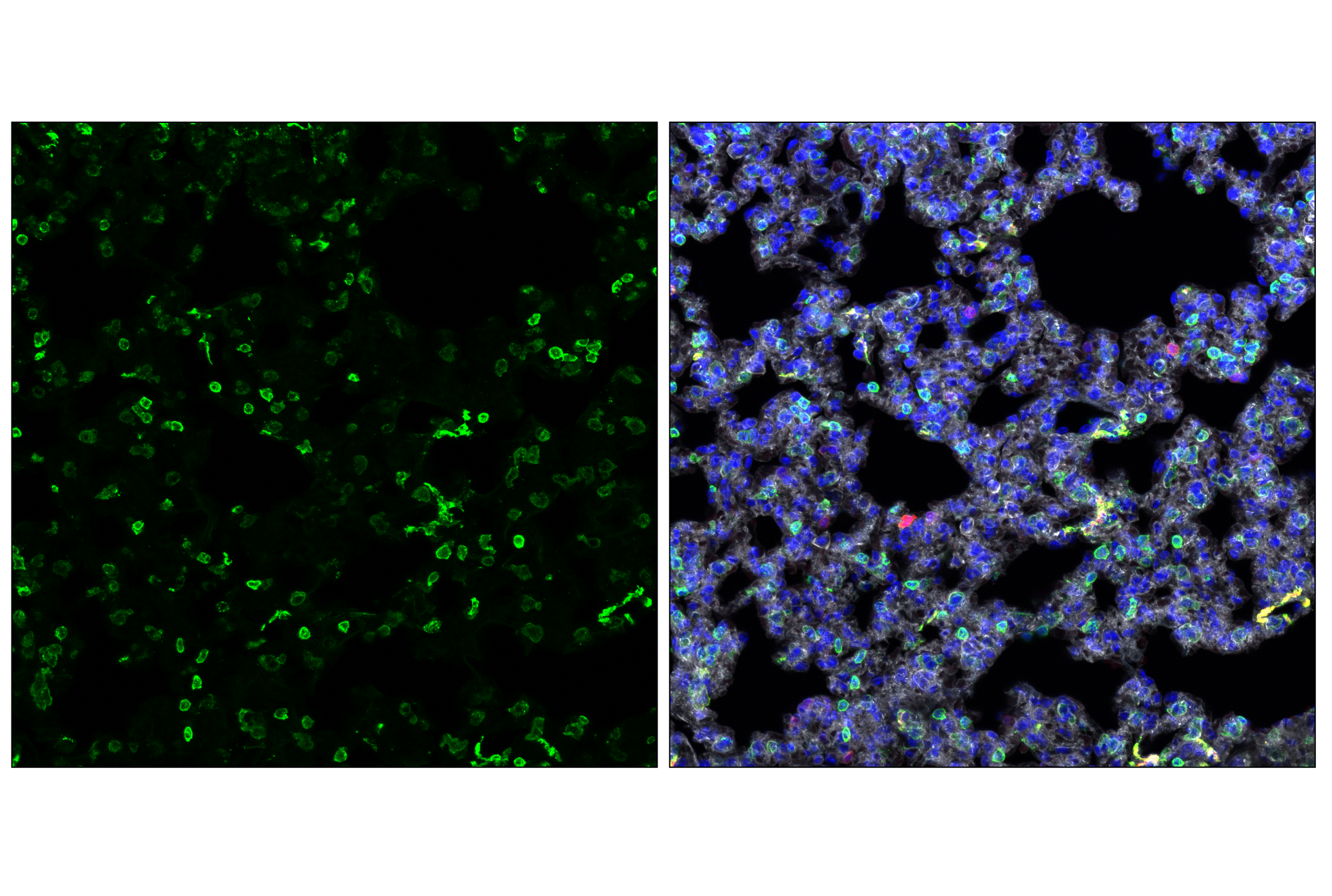 Immunofluorescence Image 2: MHC Class II (I-A/I-E) (M5/114.15.2) Rat mAb