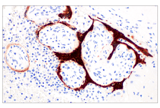 Immunohistochemistry Image 1: SARS-CoV-2 Nucleocapsid Protein (E9L7H) XP® Rabbit mAb