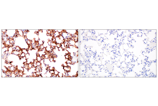 Immunohistochemistry Image 3: SARS-CoV-2 Nucleocapsid Protein (E9L7H) XP® Rabbit mAb