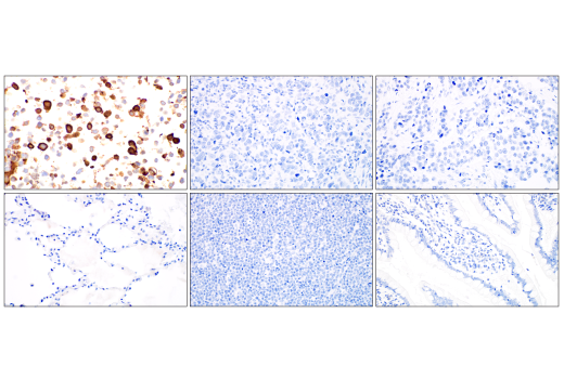 Immunohistochemistry Image 4: SARS-CoV-2 Nucleocapsid Protein (E9L7H) XP® Rabbit mAb