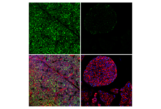 Immunofluorescence Image 1: Tox/Tox2 (E6G5O) Rabbit mAb (BSA and Azide Free)