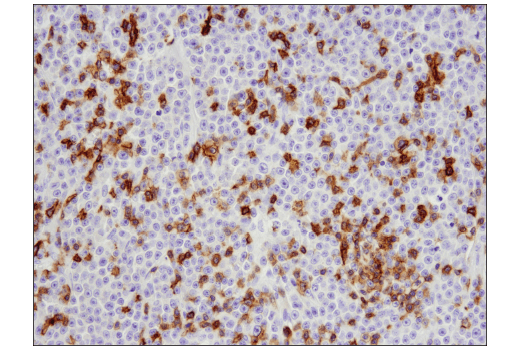 Immunohistochemistry Image 2: CD5 (E8X3S) XP® Rabbit mAb (BSA and Azide Free)