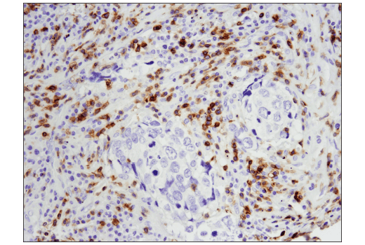 Immunohistochemistry Image 3: CD5 (E8X3S) XP® Rabbit mAb (BSA and Azide Free)