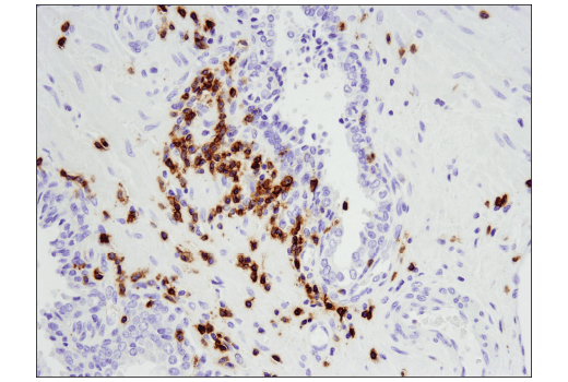 Immunohistochemistry Image 5: CD5 (E8X3S) XP® Rabbit mAb (BSA and Azide Free)