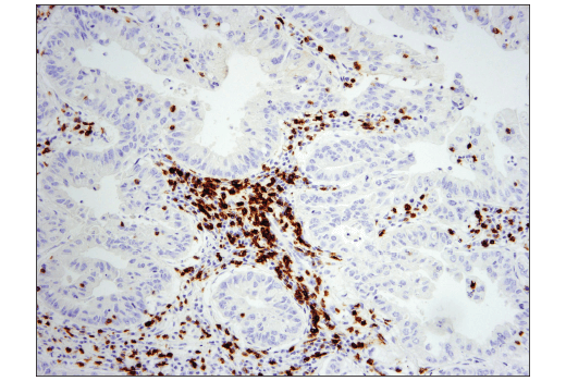 Immunohistochemistry Image 1: CD5 (E8X3S) XP® Rabbit mAb (BSA and Azide Free)