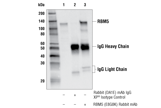 Immunoprecipitation Image 1: RBM5 (E8G8K) Rabbit mAb