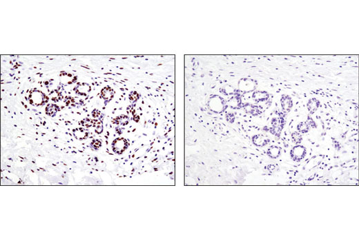 Immunohistochemistry Image 1: Acetyl-Histone H4 (Lys5) (D12B3) Rabbit mAb
