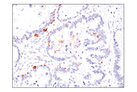 Immunohistochemistry Image 5: Axl (C89E7) Rabbit mAb (BSA and Azide Free)