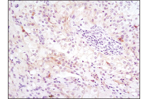 Immunohistochemistry Image 6: Axl (C89E7) Rabbit mAb (BSA and Azide Free)