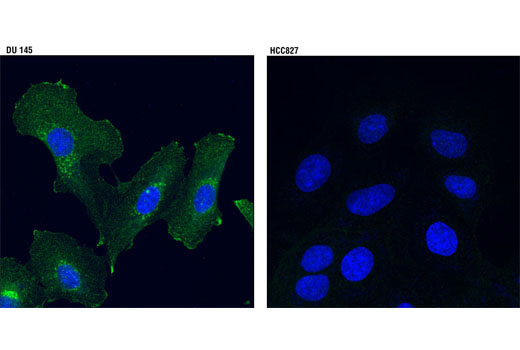 Immunofluorescence Image 1: Axl (C89E7) Rabbit mAb (BSA and Azide Free)