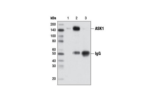 Immunoprecipitation Image 1: ASK1 (D11C9) Rabbit mAb