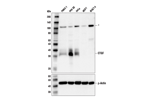  Image 12: YAP/TAZ Transcriptional Targets Antibody Sampler Kit