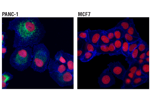  Image 19: YAP/TAZ Transcriptional Targets Antibody Sampler Kit