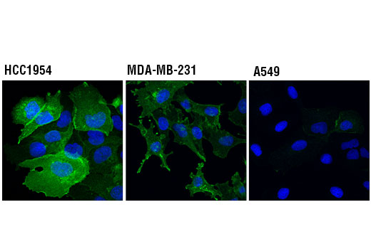 Immunofluorescence Image 1: PD-L1 (Extracellular Domain Specific) (D8T4X) Rabbit mAb