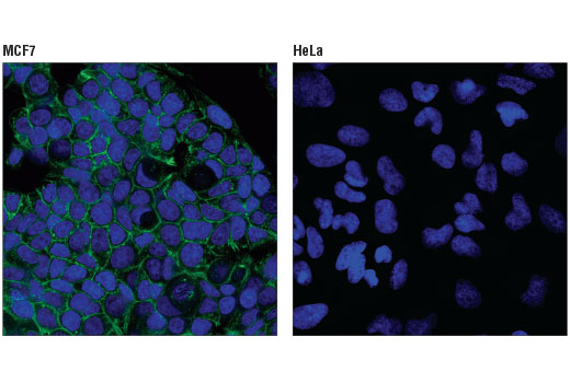 Immunofluorescence Image 1: E-Cadherin (4A2) Mouse mAb (Alexa Fluor® 488 Conjugate)