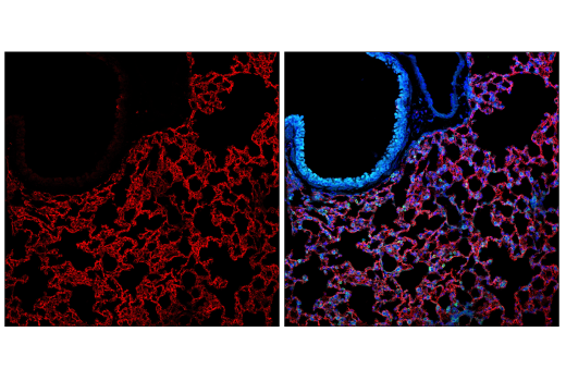 Immunofluorescence Image 1: CD36 (E8B7S) Rabbit mAb (BSA and Azide Free)
