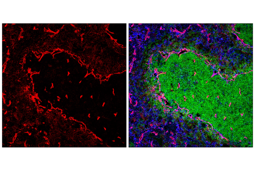 Immunofluorescence Image 2: CD36 (E8B7S) Rabbit mAb (BSA and Azide Free)