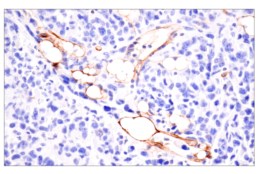 Immunohistochemistry Image 7: CD36 (E8B7S) Rabbit mAb (BSA and Azide Free)