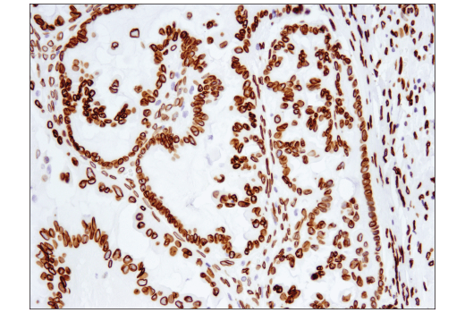 Immunohistochemistry Image 3: Lamin A (133A2) Mouse mAb