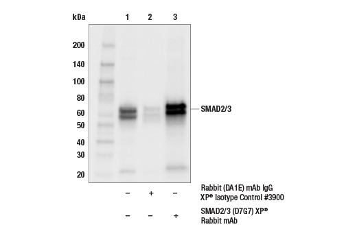 Immunoprecipitation Image 1: SMAD2/3 (D7G7) XP® Rabbit mAb