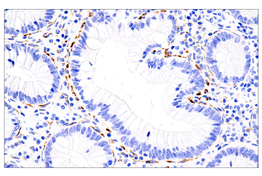 Immunohistochemistry Image 7: COL5A1 (E6U9W) Rabbit mAb
