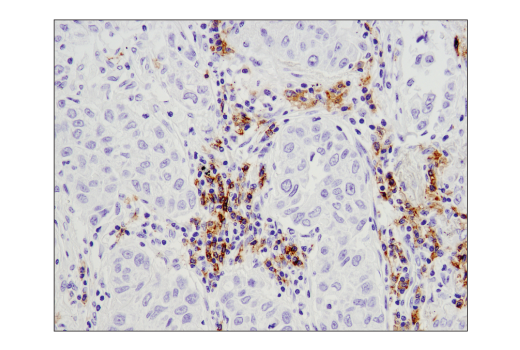 Immunohistochemistry Image 3: CD19 (Intracellular Domain) (D4V4B) XP® Rabbit mAb (BSA and Azide Free)