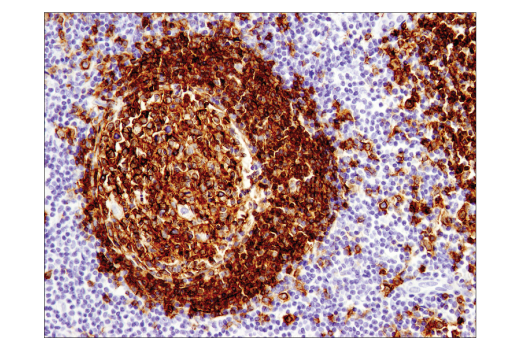 Immunohistochemistry Image 2: CD19 (Intracellular Domain) (D4V4B) XP® Rabbit mAb (BSA and Azide Free)