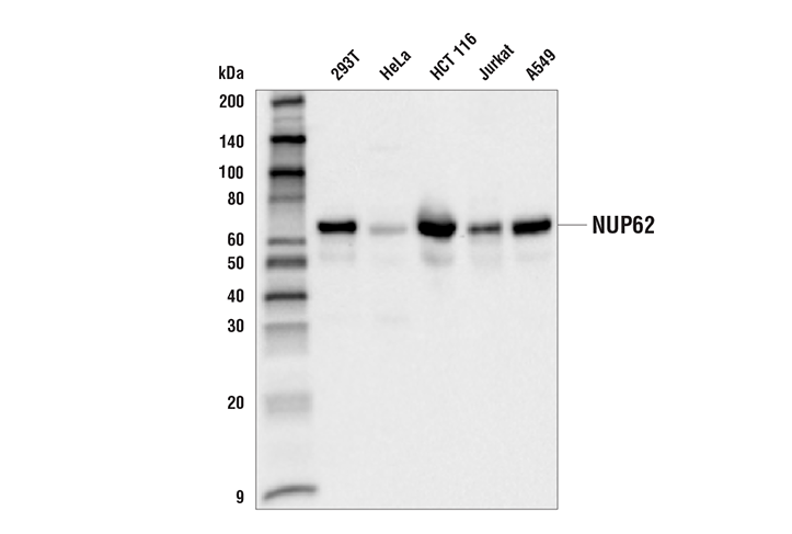 Western Blotting Image 1: NUP62 Antibody